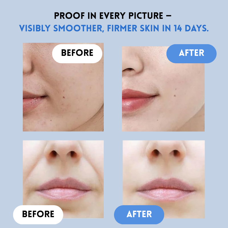 DermaLift™ Skin Smoothing Strips