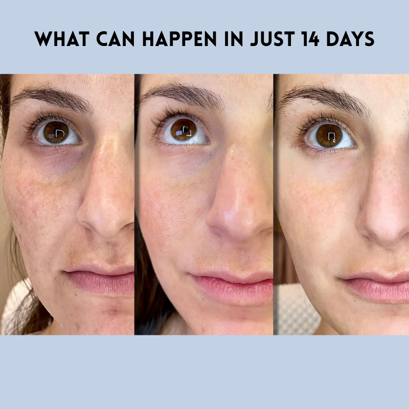 DermaLift™ Skin Smoothing Strips