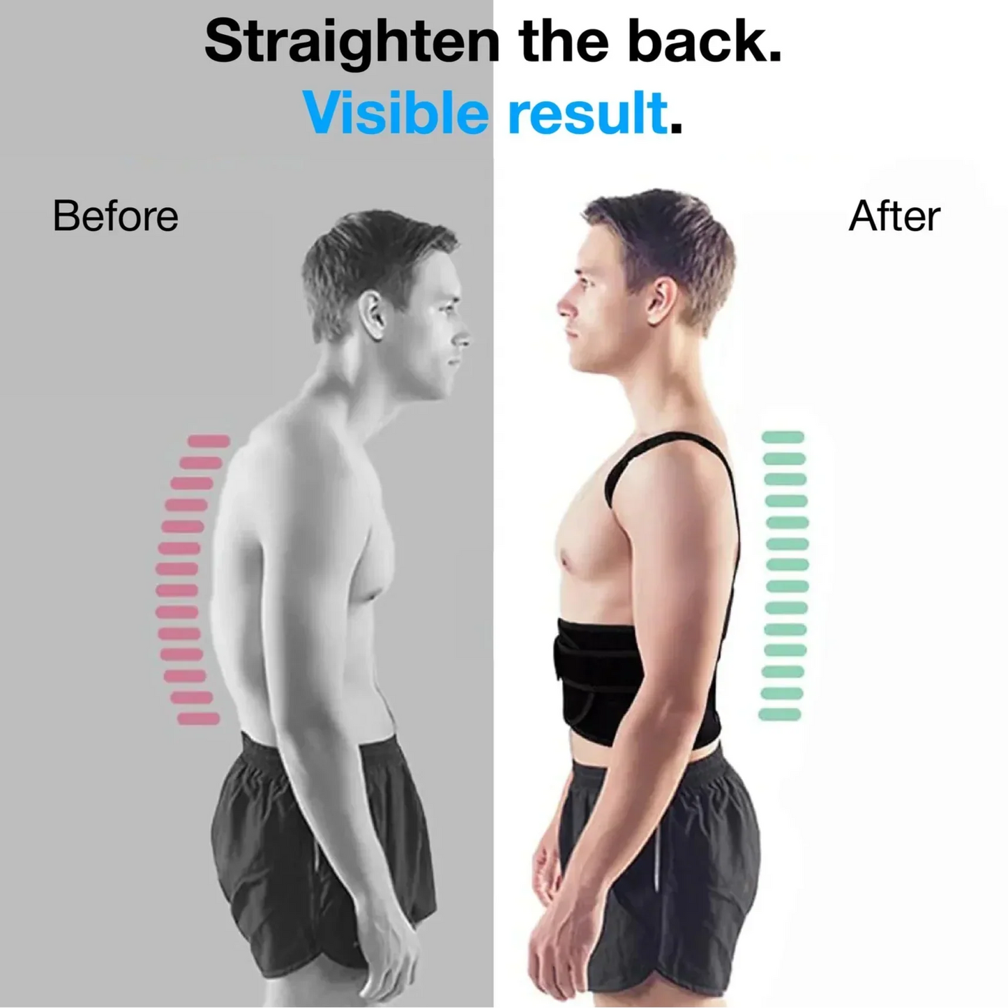 PostureAlign™ — Stand Taller & End Back Pain (50% OFF)