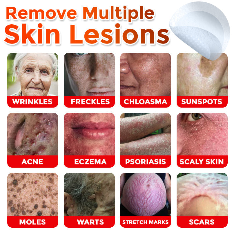 ClearPatch™ Microneedle Blemish Removal Patch — 50% OFF Today