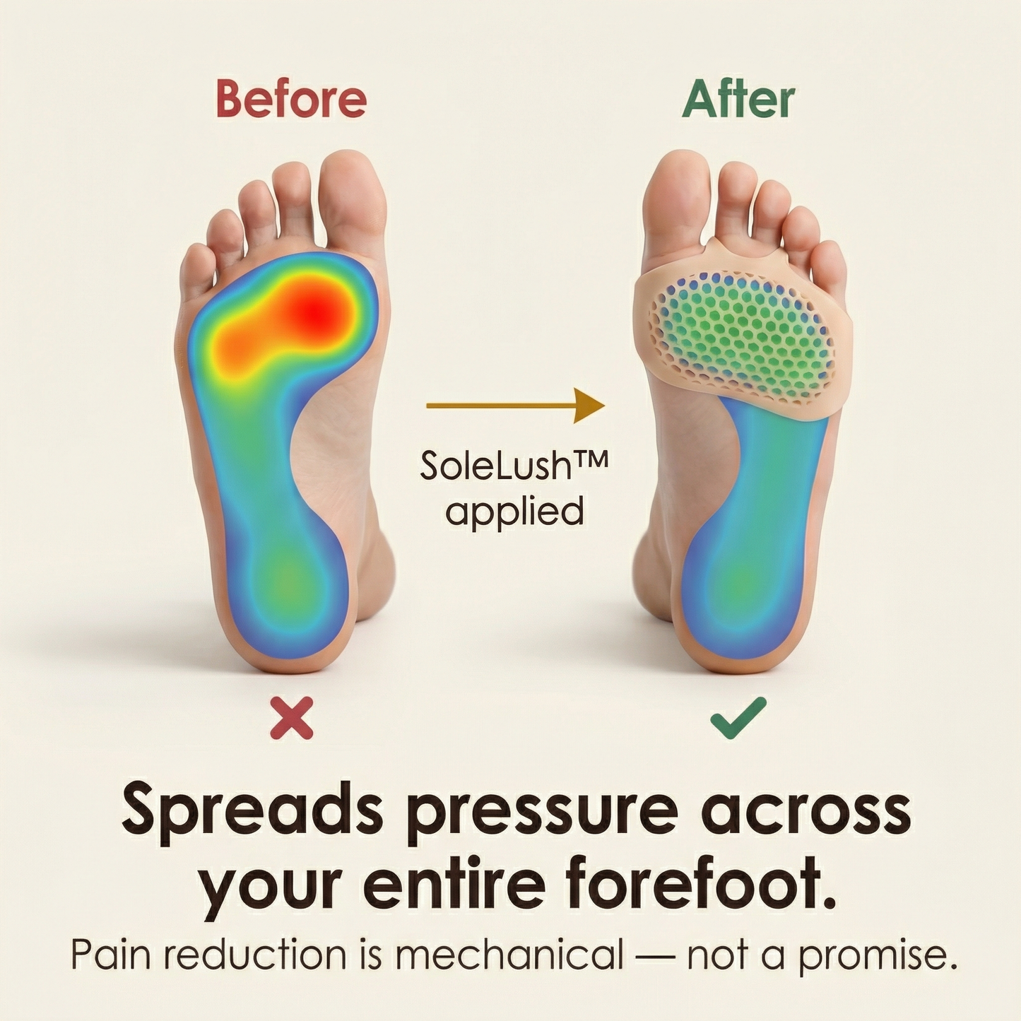 StepSoft™ | Ball of Foot Cushion Pads